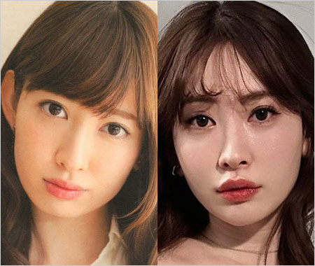 小嶋陽菜の整形疑惑、顔比較写真