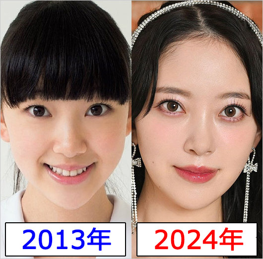 堀未央奈の美容整形疑惑、デビュー時と現在の顔比較のビフォー・アフター画像