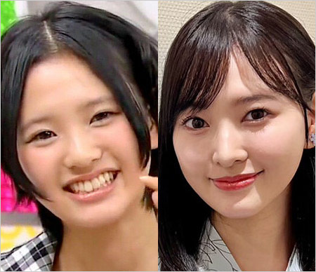 兒玉遥が整形前と整形後の変化ビフォーアフター画像