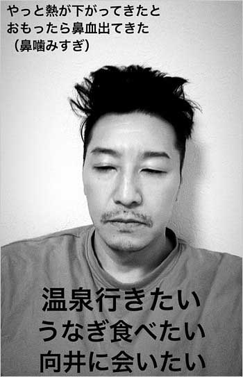 チョコレートプラネット長田庄平が体調不良で鼻血