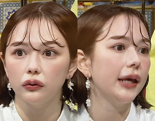 村重杏奈が唇整形？踊る！さんま御殿!!出演時の顔画像