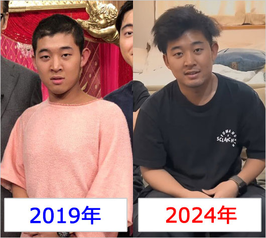 四千頭身の後藤拓実が激太り前後のビフォーアフター画像