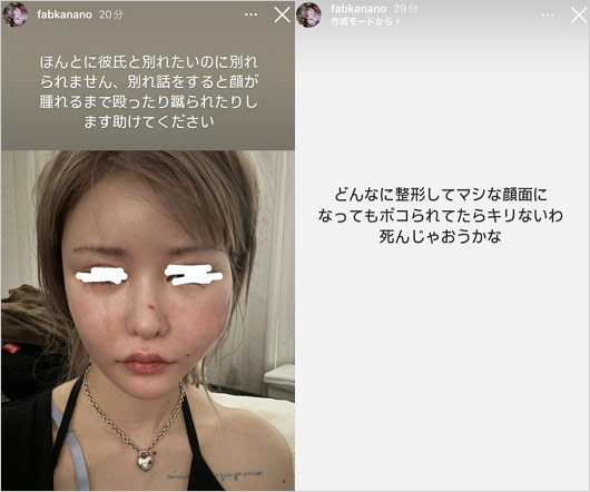 戦慄かなのがDJまるから暴行被害訴えたインスタストーリー画像