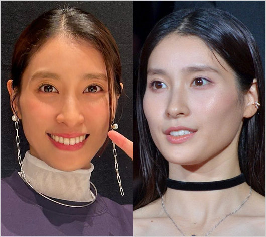 激ヤセした土屋太鳳の画像（オールスター感謝祭出演前）