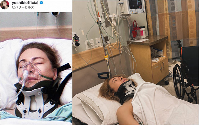 YOSHIKIが3度目の首手術後の画像