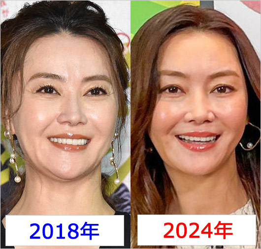 観月ありさの顔比較