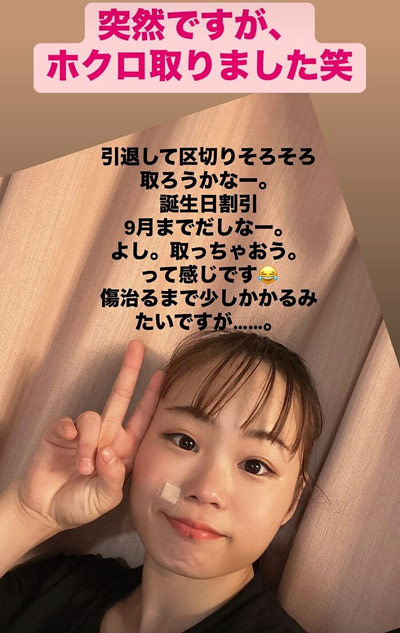宮川紗江がホクロ取ったと報告のインスタグラム画像