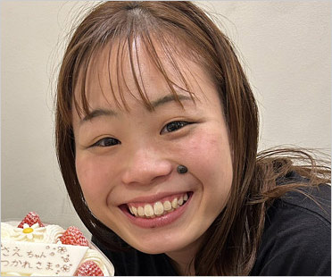 宮川紗江がホクロ取る前の画像