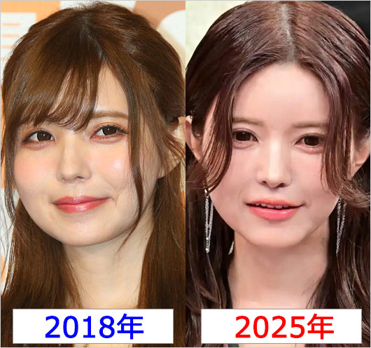 益若つばさ顔の変化・最新ビフォーアフター画像