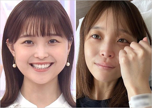元フジテレビ渡邊渚アナウンサーが激ヤセ前と入院直後の画像
