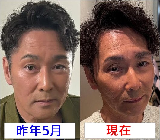 元木大介が激ヤセ前後のビフォーアフター比較画像
