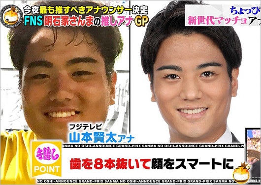 フジテレビ山本賢太アナが整形前と顔イジった後の画像