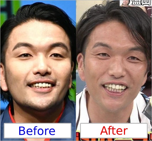 見取り図・盛山晋太郎がダイエット・ビフォー・アフターの顔画像