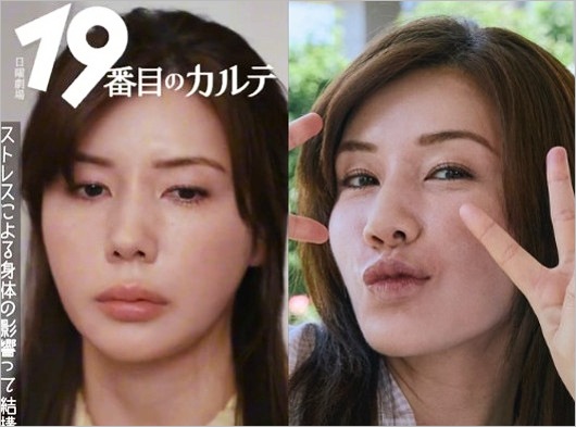 仲里依紗『19番目のカルテ』出演、唇が分厚くなった近影