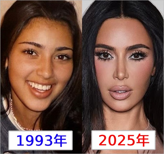 キム・カーダシアンの整形前後の画像