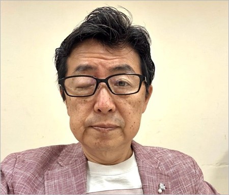 帯状疱疹で右目が腫れた笠井信輔アナウンサー