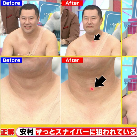 ラヴィット!とにかく明るい安村にレーザーポインターでレーザー照射