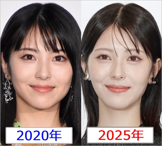 浜辺美波の整形疑惑、過去と現在の顔比較画像