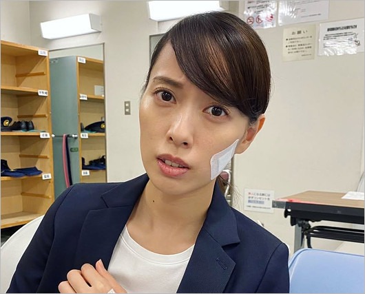 戸田恵梨香が激ヤセ、頬がコケたハコヅメ出演時の画像