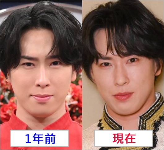 Snow Man宮舘涼太が激ヤセ？1年前との顔比較画像