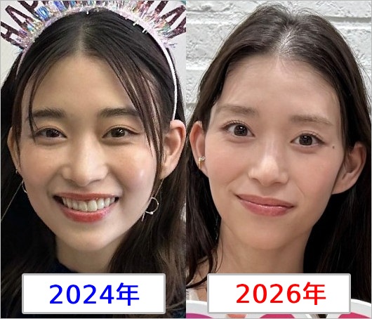 森川葵が激ヤセ前と後のビフォーアフター