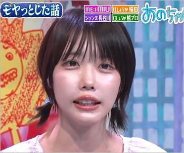 あのちゃん