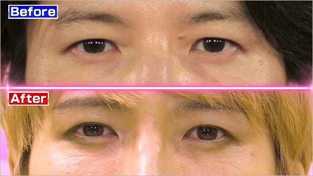 『ビューティースタジアム』田口淳之介が目整形前後のビフォー・アフター