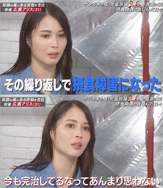 広瀬アリスが過食嘔吐・摂食障害を告白したシーン