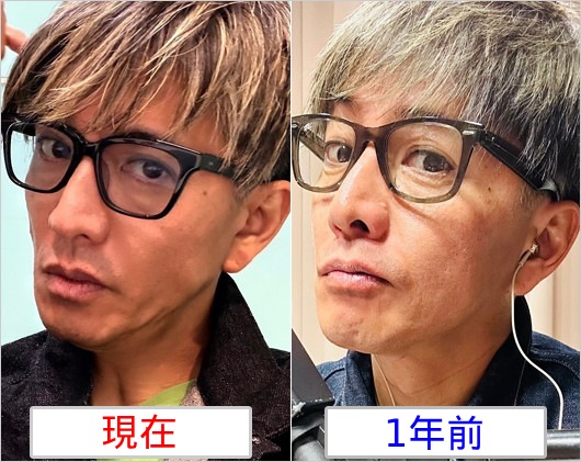 木村拓哉が激ヤセ疑惑、1年前との顔比較