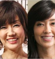 松本伊代と早見優